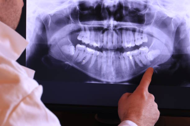 Best Emergency Dentist for Special Needs Patients in Lexington, TN