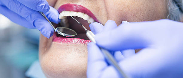 Best Emergency Dentist for Special Needs Patients in Lexington, TN